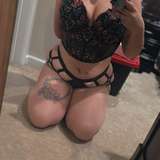 amputee-rena
